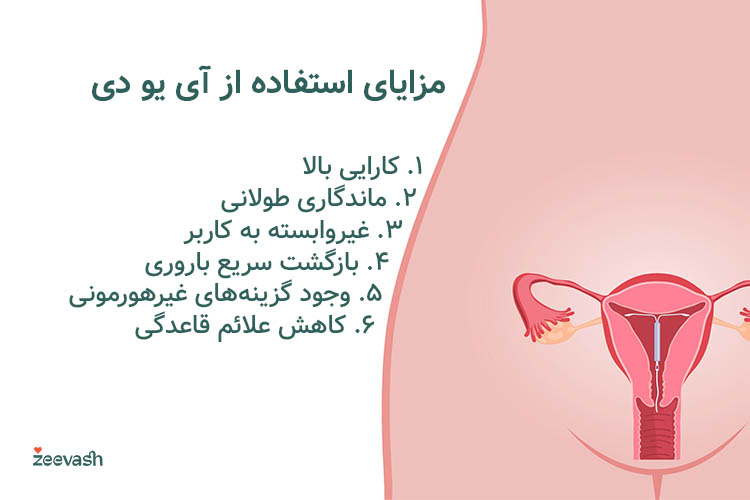 آی یو دی به دلیل کارایی بالا، ماندگاری طولانی و سهولت استفاده، یکی از بهترین روش‌های پیشگیری از بارداری است.